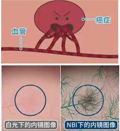 【40岁以上必读】一旦出现类似症状，及时做这个检查或可救你一命