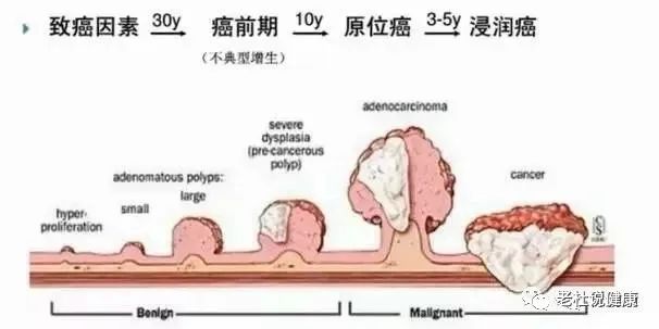 假如我没有坚持，这个肠癌就可能漏诊了！——便血，可别轻易当痔疮