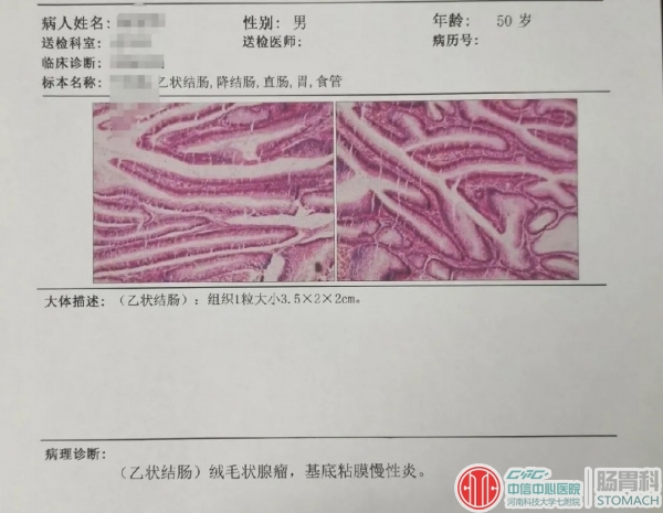 医生手记：过了四十岁一定要做次肠镜检查，关键时刻能救命！