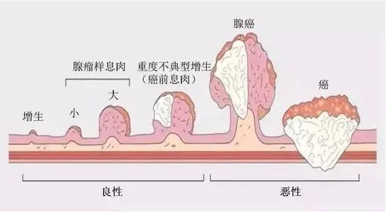 家人有肠息肉，亲属得肠道病变的几率有多高？