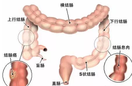 导致慢性胃炎的病因有什么