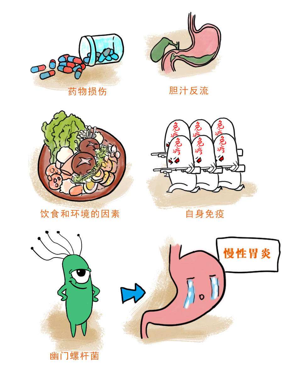 诊断慢性胃炎的方法 日常如何避免慢性胃炎