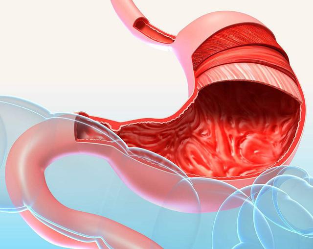 消化科大夫提醒：这4个信号或不是胃炎！不妨了解