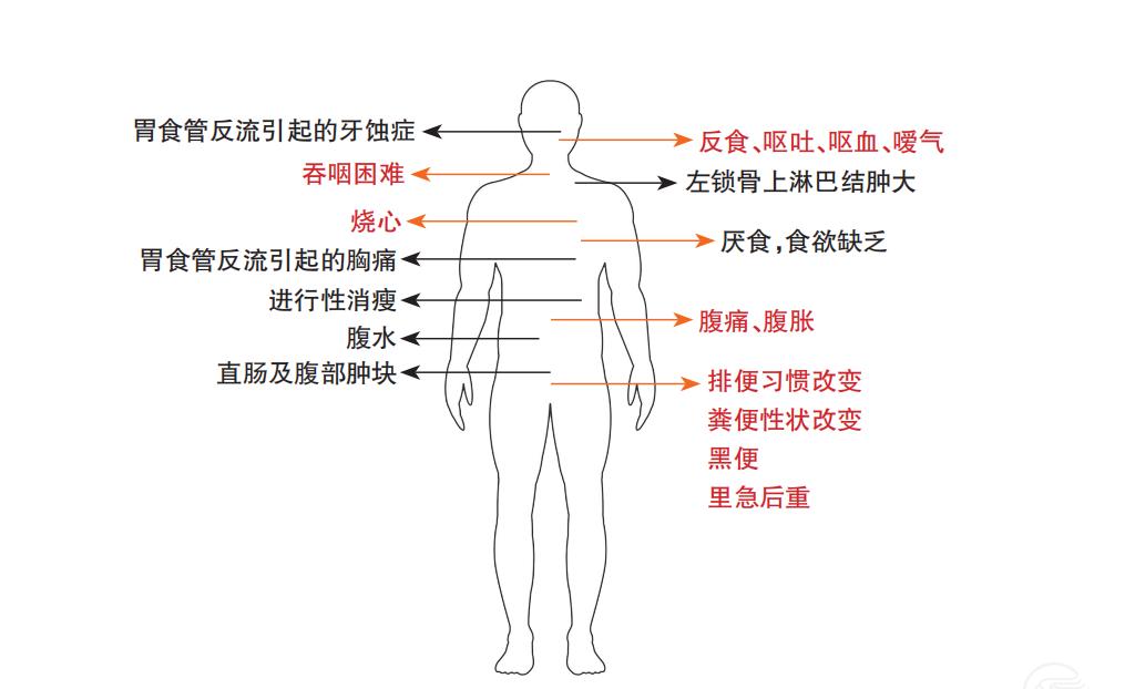 原来消化系统疾病会有这么多症状